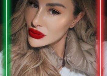 Ninel Conde se hace un retoque en la cara y luce irreconocible