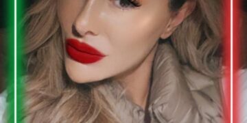 Ninel Conde se hace un retoque en la cara y luce irreconocible