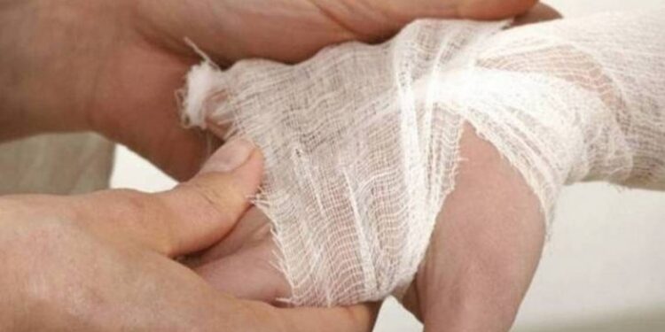 Descartan alerta por lepra en el país