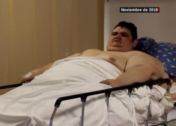 Fue el hombre más obeso del mundo y sobrevivió al covid-19