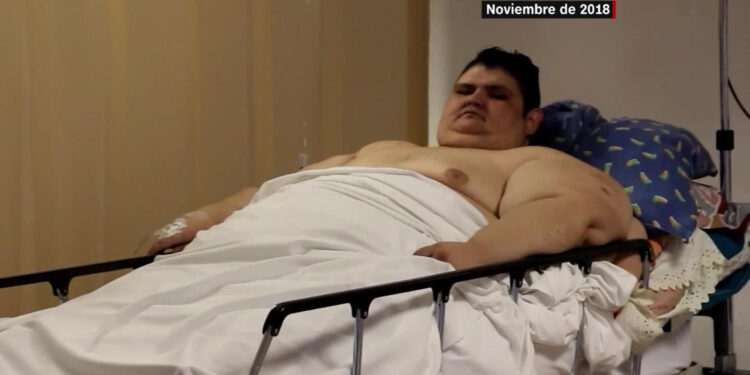 Fue el hombre más obeso del mundo y sobrevivió al covid-19