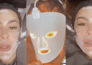 Aseguran que Ninel Conde "asusta" con su cara, ¿Qué se hizo?