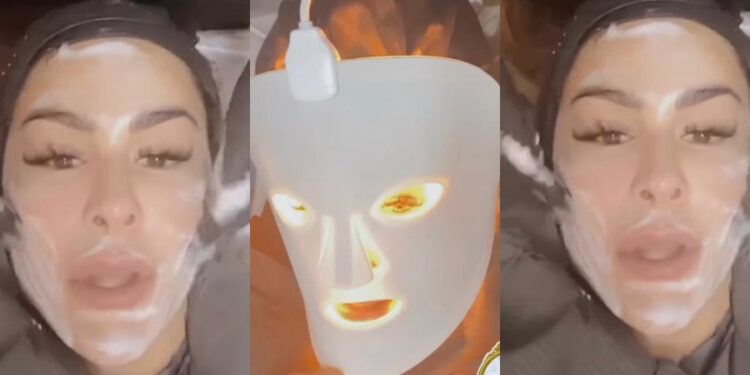Aseguran que Ninel Conde "asusta" con su cara, ¿Qué se hizo?