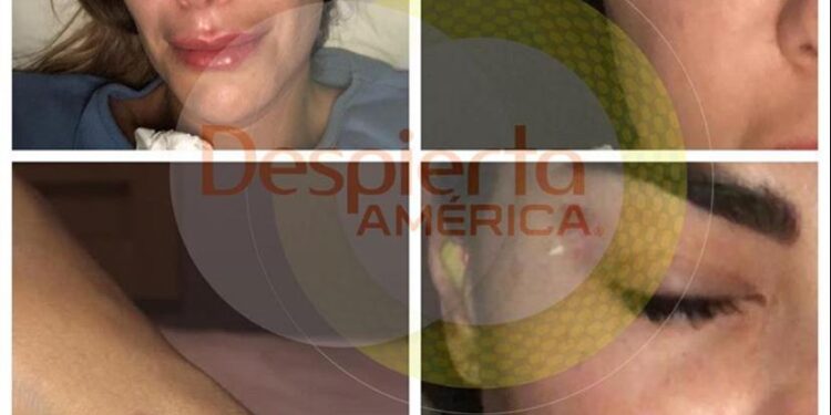 Filtran fotos de Ninel Conde golpeada y signos de violencia