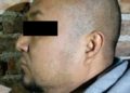 Juez ordena a autoridades suministrarle medicamentos a El Marro, líder del Cartel Santa Rosa de Lima - Noticias, Deportes, Gossip, Columnas