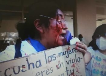 Sobrina de Salgado Macedonio agrade a activista en Iguala - Noticias, Deportes, Gossip, Columnas