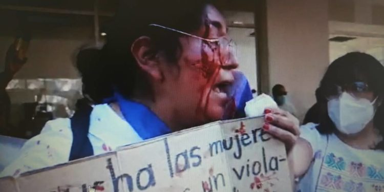 Sobrina de Salgado Macedonio agrade a activista en Iguala - Noticias, Deportes, Gossip, Columnas