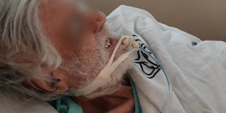 Viejito muere en el IMSS y le roban su dentadura de oro - Noticias, Deportes, Gossip, Columnas