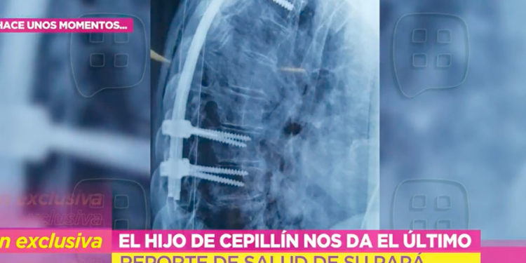 Cepillín
