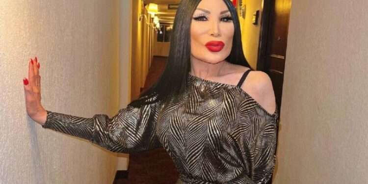 Lyn May sufre fuerte caída a sus 70 años
