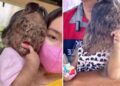 Ella es la 'niña del cielo', una pequeña que tiene el síndrome del hombre lobo