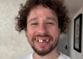 Luisito Comunica revela la verdad sobre el perturbador video donde se 'le caen los dientes'