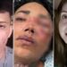 Maryfer Centeno analiza a prometido de Paola Suárez luego de la terrible golpiza que le dio a la influencer