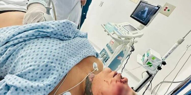 Paola-Suárez-de-Las-Perdidas-podría-perder-un-ojo-y-tiene-dos-costillas-rotas.jpg
