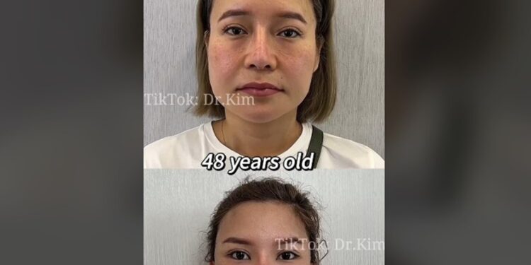 Quién es Dr Kim, el cirujano plástico que impactó en TikTok por sus perturbadores videos