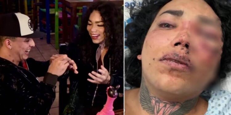 Quién es el novio de Paola Suárez que la mandó al hospital por brutal golpiza tras pedirle matrimonio