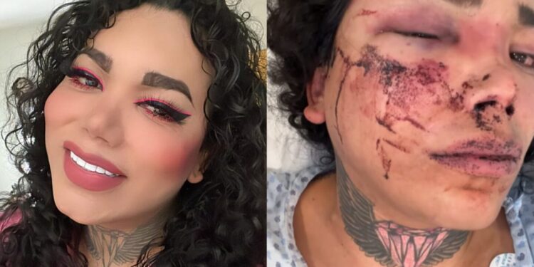 ¿Quién es Paola Suárez, la integrante de 'Las perdidas' que fue golpeada por su novio?