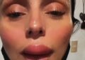 Ivonne Montero apareció con un labio hinchado y preocupó a sus fans, ¿qué le pasó?