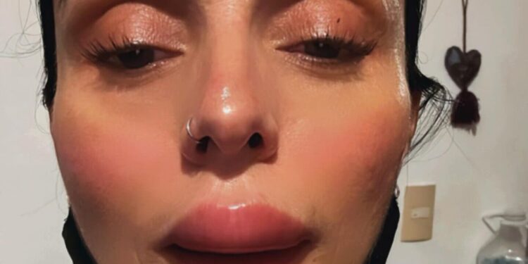 Ivonne Montero apareció con un labio hinchado y preocupó a sus fans, ¿qué le pasó?