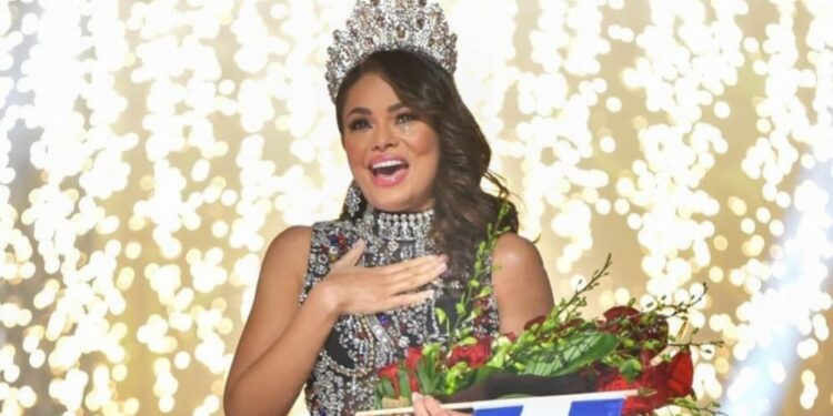 La reina de belleza Sirey Morán presumió los increíbles resultados de su liposucción con este sensual VIDEO