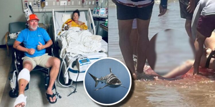 El aterrador testimonio de la mujer que perdió la pierna por un ataque de tiburón en Texas: VIDEO
