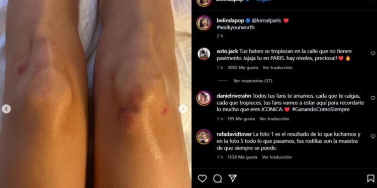 belinda caida paris moretones