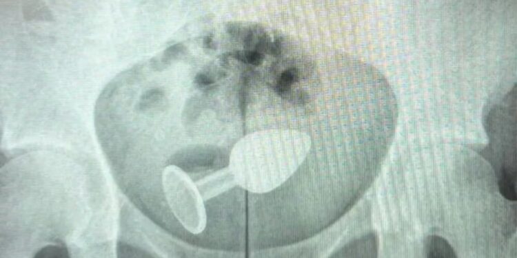 plug-radiografia.jpg