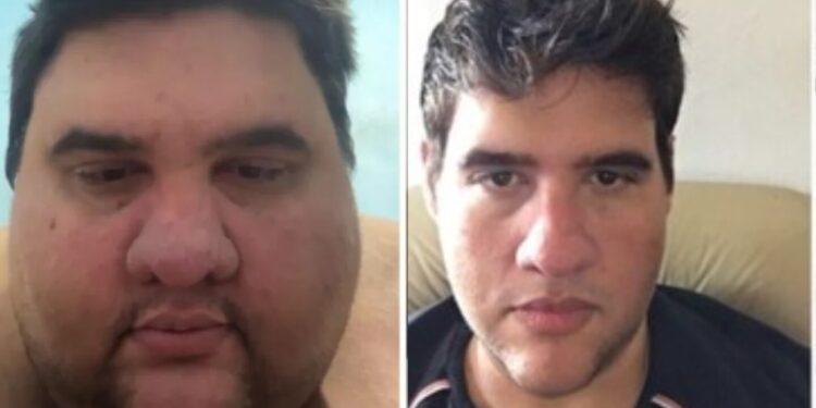 Quién era Gabriel Freitas, el influencer que murió tras perder 200 kilos de peso