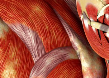 ¿Son reales las contracturas musculares?