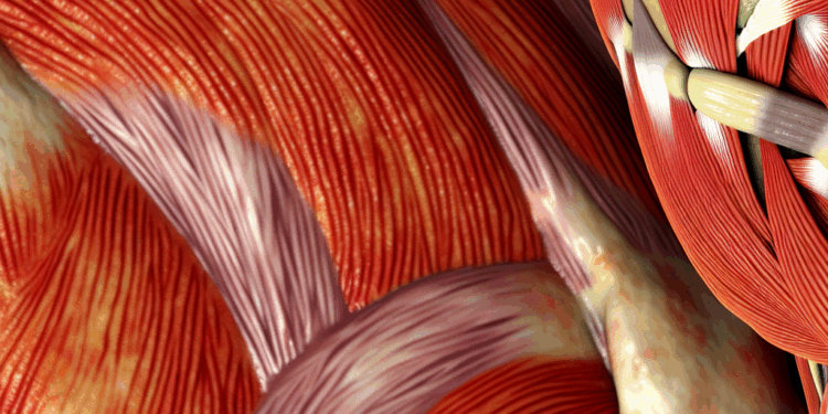 ¿Son reales las contracturas musculares?