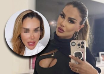 Ninel Conde cambia el color de sus ojos a verde olivo con riesgoso procedimiento