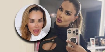 Ninel Conde cambia el color de sus ojos a verde olivo con riesgoso procedimiento