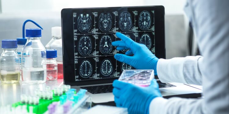 Avances contra la enfermedad de Alzheimer | Materia gris | Ciencia